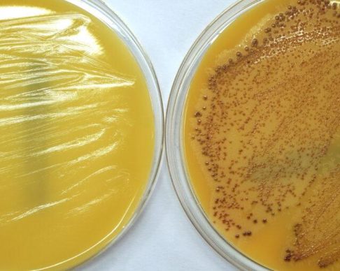 Petri,Dish,With,Staphylococcus,Aureus,Culture.,Positive,And,Negative,Mrsa